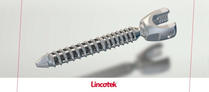 Lincotek reçoit un brevet pour une vis orthopédique imprimée en 3D